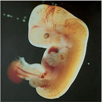Fetus 6 week